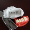 dental alginate impression material color changing outcomes models