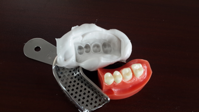 dental alginate impression material color changing outcomes models