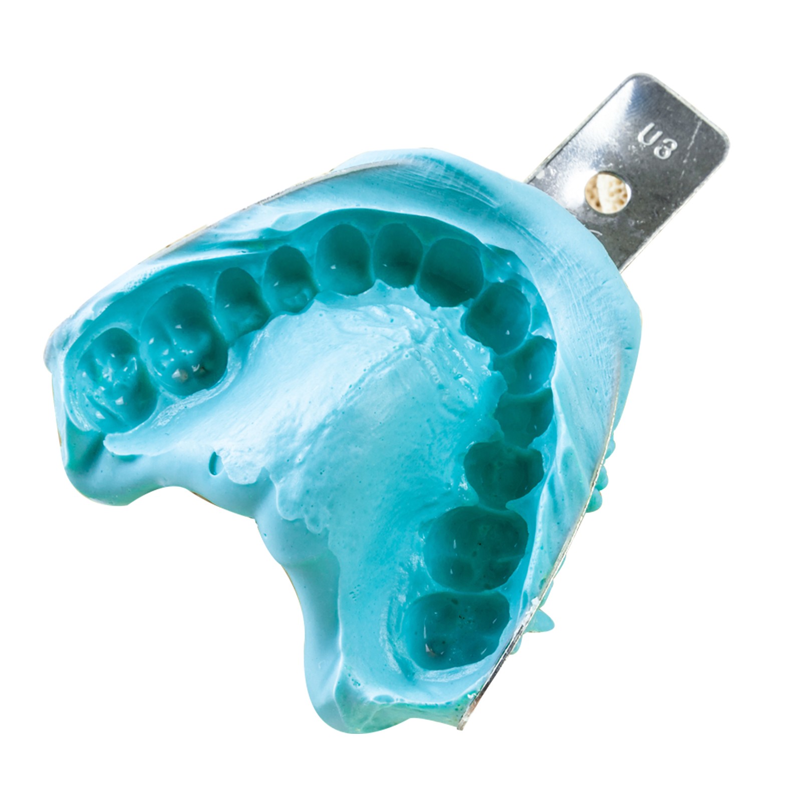 alginate impression alginate impression